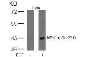 Western blot analysis of extracts from Hela cells untreated or treated with EGF using MEK1(Phospho-Ser221) Antibody. (MEK1 Antikörper  (pSer221))