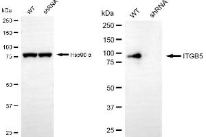 Western blotting analysis using ITGB5 antibody (ABIN7799074). (Rekombinanter Integrin beta 5 Antikörper)