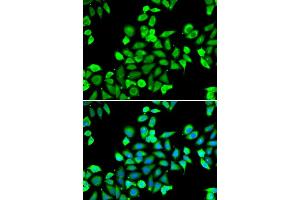 Immunofluorescence analysis of A549 cell using CDC16 antibody. (CDC16 Antikörper)