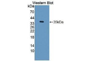 Western blot analysis of the recombinant protein. (TKT Antikörper  (AA 1-286))