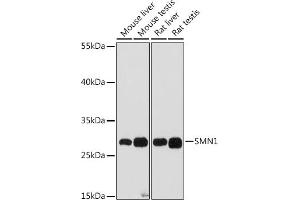 Western blot analysis of extracts of various cell lines, using SMN1 antibody (ABIN7270652) at 1:1000 dilution. (SMN1 Antikörper  (AA 80-150))