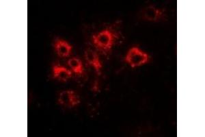 Immunofluorescent analysis of Tapasin staining in Hela cells. (TAPBP Antikörper  (full length))