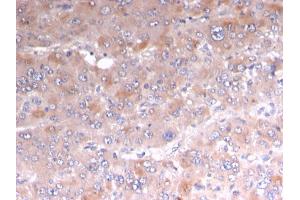 Formalin-fixed, paraffin-embedded human Adrenal stained with Adipophilin Recombinant Mouse Monoclonal Antibody (rADFP/1493). (Rekombinanter ADRP Antikörper  (AA 249-376))