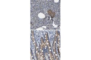 Immunohistochemical staining of human duodenum with TOR1B polyclonal antibody  shows moderate cytoplasmic positivity in glandular cells. (TOR1B Antikörper)