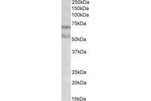Western Blotting (WB) image for anti-Cannabinoid Receptor 1 (CNR1) (AA 77-91) antibody (ABIN793332) (CNR1 Antikörper  (AA 77-91))