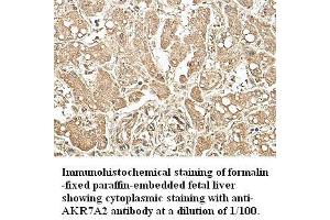 Image no. 1 for anti-Aflatoxin Beta1 Aldehyde Reductase (AKR7A2) antibody (ABIN791187) (AKR7A2 Antikörper)
