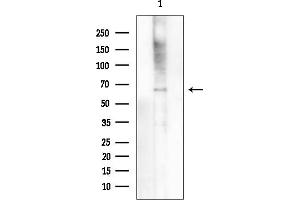 anti-NEDD4 Binding Protein 2-Like 2 (N4BP2L2) (Internal Region) antibody