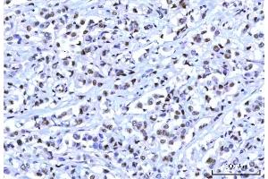 IHC analysis of RBM15B using anti-RBM15B antibody (ABIN7600219).