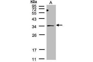 WB Image Sample(30 μg of whole cell lysate) A:HeLa S3, 12% SDS PAGE antibody diluted at 1:500 (ST3GAL1 Antikörper)