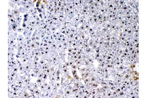 IHC analysis of VEGF Receptor 3 using anti-VEGF Receptor 3 antibody . (FLT4 Antikörper  (AA 25-259))