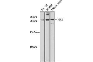 Western blot analysis of extracts of various cell lines using IGF2 Polyclonal Antibody at dilution of 1:1000. (IGF2 Antikörper)