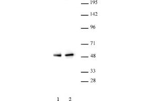 PAX5 antibody (pAb) tested by Western blot. (PAX5 Antikörper  (N-Term))