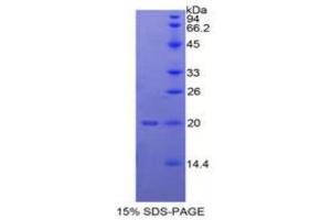 SDS-PAGE (SDS) image for Matrix Metallopeptidase 13 (Collagenase 3) (MMP13) (AA 62-217) protein (His tag) (ABIN2121617)