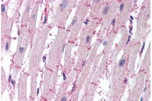 Human Heart (formalin-fixed, paraffin-embedded) stained with ATG4B antibody ABIN295502 at 10 ug/ml followed by biotinylated goat anti-rabbit IgG secondary antibody ABIN481713, alkaline phosphatase-streptavidin and chromogen. (ATG4B Antikörper  (AA 350-400))