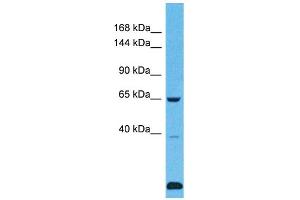 Host: Rabbit Target Name: USP43 Sample Type: Fetal Lung lysates Antibody Dilution: 1. (USP43 Antikörper  (C-Term))