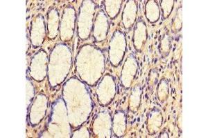 Immunohistochemistry of paraffin-embedded human stomach tissue using ABIN7175770 at dilution of 1:100