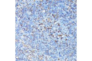 Immunohistochemistry of paraffin-embedded mouse spleen using CXCR1 antibody (ABIN7266317) at dilution of 1:100 (40x lens). (CXCR1 Antikörper  (AA 250-350))