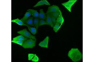 Immunofluorescence staining of Hela cells with ABIN7139835 at 1:50, counter-stained with DAPI. (FOXO4 Antikörper  (AA 45-63))