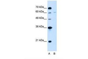 Image no. 2 for anti-Chromatin Assembly Factor 1, Subunit B (p60) (CHAF1B) (C-Term) antibody (ABIN320995) (CHAF1B Antikörper  (C-Term))