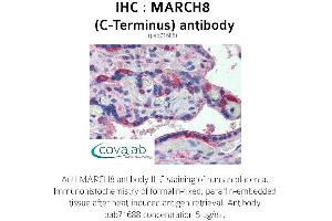 Image no. 1 for anti-Membrane-Associated Ring Finger (C3HC4) 8, E3 Ubiquitin Protein Ligase (MARCH8) (C-Term) antibody (ABIN1736759) (MARCH8 Antikörper  (C-Term))