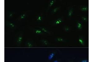 Immunofluorescence analysis of U-2 OS cells using HNF4G Polyclonal Antibody at dilution of 1:100 (40x lens). (HNF4 gamma Antikörper)