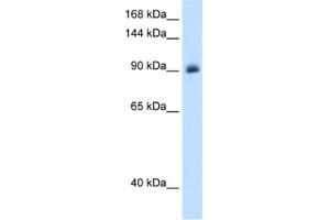Western Blotting (WB) image for anti-Nuclear Receptor Subfamily 3, Group C, Member 2 (NR3C2) antibody (ABIN2462859)
