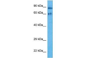 Host:  Rabbit  Target Name:  RIPK4  Sample Tissue:  Human HT1080 Whole Cell  Antibody Dilution:  1ug/ml (RIPK4 Antikörper  (Middle Region))