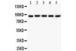 Western Blotting (WB) image for anti-Villin 1 (VIL1) (AA 770-799), (C-Term) antibody (ABIN3042343)