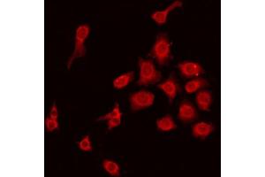 ABIN6275220 staining HepG2 by IF/ICC. (MBL2 Antikörper  (N-Term))