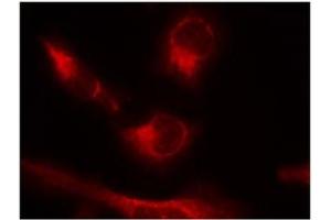 Image no. 2 for anti-Microtubule-Associated Protein tau (MAPT) (pSer356) antibody (ABIN319219) (MAPT Antikörper  (pSer356))