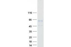 Validation with Western Blot