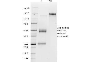 SDS-PAGE Analysis Purified Vitronectin Receptor Mouse Monoclonal Antibody (23C6). (CD51 Antikörper)