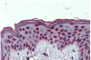 Human Skin: Formalin-Fixed, Paraffin-Embedded (FFPE) (HMGA1 Antikörper  (AA 9-21))