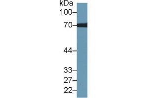 Detection of TKT in Human Hela cell lysate using Polyclonal Antibody to Transketolase (TKT) (TKT Antikörper  (AA 1-286))
