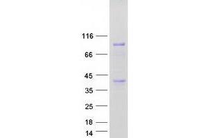 Validation with Western Blot (ANKZF1 Protein (Transcript Variant 2) (Myc-DYKDDDDK Tag))