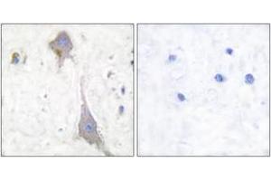 Immunohistochemistry (IHC) image for anti-Glutamate Receptor, Metabotropic 7 (GRM7) (AA 866-915) antibody (ABIN2889207) (GRM7 Antikörper  (AA 866-915))
