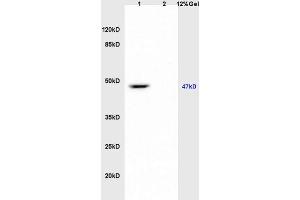 Lane 1: mouse brain lysates Lane 2: mouse heart lysates probed with Anti kir 6.