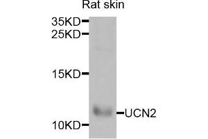Western blot analysis of extracts of rat skin cells, using UCN2 antibody. (Urocortin 2 Antikörper)