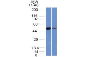 Western Blot of K562 and Lung lysate ALDH1A1 Mouse Monoclonal Antibody (ALDH1A1/1381). (ALDH1A1 Antikörper  (AA 315-434))