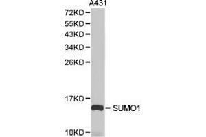 Western Blotting (WB) image for anti-Small Ubiquitin Related Modifier Protein 1 (SUMO1) antibody (ABIN1874993)
