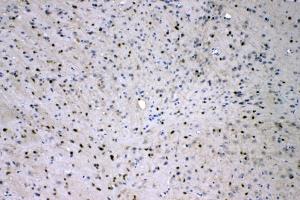IHC analysis of ADO using anti-ADO antibody (ABIN4886431). (ADO Antikörper  (AA 49-261))