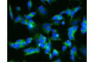 Immunofluorescent staining of SH-SY5Y cells (Second Panel). (CPE Antikörper  (AA 49-200))