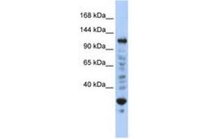 Image no. 1 for anti-Nuclear Transcription Factor, X-Box Binding 1 (NFX1) (N-Term) antibody (ABIN6740397) (NFX1 Antikörper  (N-Term))