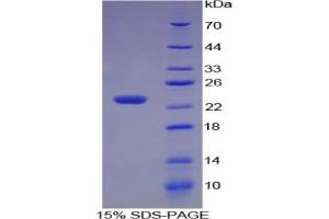 SDS-PAGE analysis of Human Matrix Metalloproteinase 3 (MMP3) Protein.