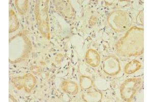 Immunohistochemistry (IHC) image for anti-Glypican 4 (GPC4) (AA 19-210) antibody (ABIN7154273)
