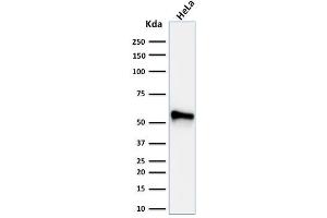 Western Blot Analysis of human HeLa cell lysate using Cytokeratin 7 Mouse Monoclonal Antibody (KRT7/760 + KRT7/903). (Cytokeratin 7 Antikörper)