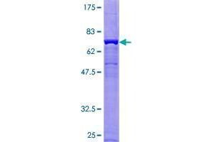 Image no. 1 for Calcium Activated Nucleotidase 1 (CANT1) (AA 1-401) protein (GST tag) (ABIN1347962)