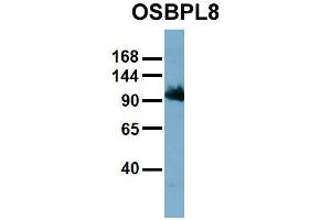 Host:  Rabbit  Target Name:  OSBPL8  Sample Type:  HT1080  Antibody Dilution:  1. (OSBPL8 Antikörper  (Middle Region))