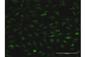 Immunofluorescence of monoclonal antibody to S100A7 on HeLa cell. (S100A7 Antikörper  (AA 1-101))