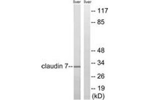 Western blot analysis of extracts from rat liver cells, using Claudin 7 (Ab-210) Antibody.